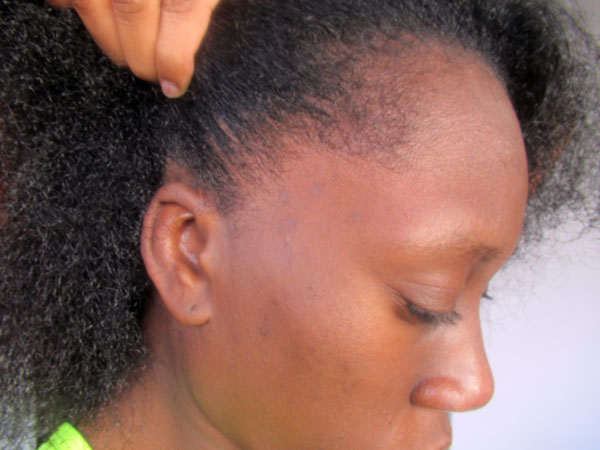Relaxer after Relaxer; EEMSDIARY