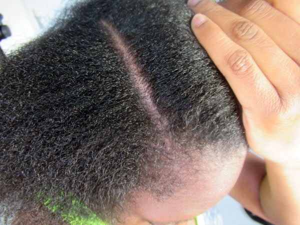 Relaxer after Relaxer; EEMSDIARY
